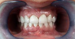 Best cosmetic dentist best cosmetic dentist